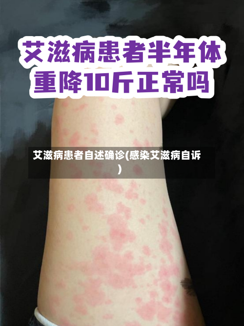 艾滋病患者自述确诊(感染艾滋病自诉)