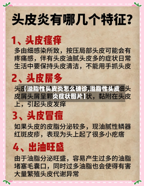【溢脂性头皮炎怎么确诊,溢脂性头皮炎症状图片】-第2张图片