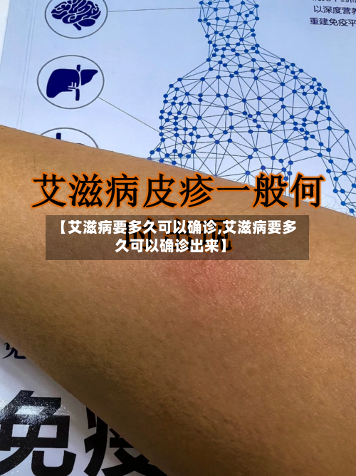 【艾滋病要多久可以确诊,艾滋病要多久可以确诊出来】