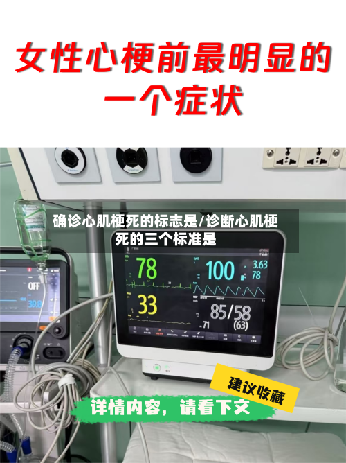 确诊心肌梗死的标志是/诊断心肌梗死的三个标准是-第2张图片