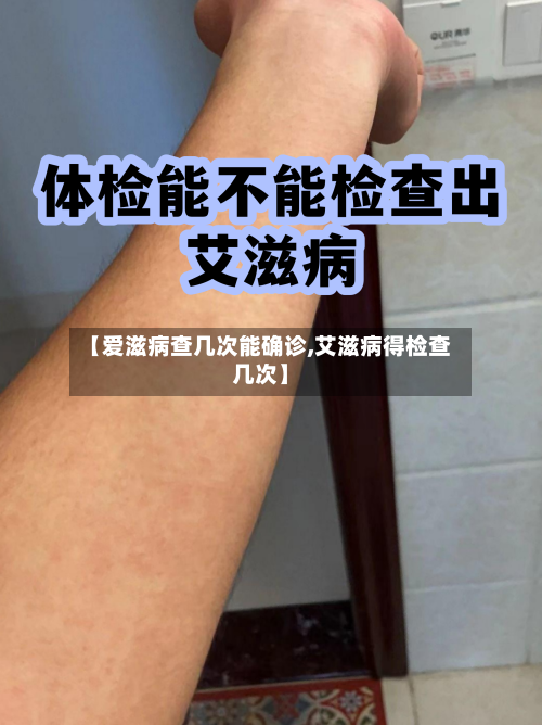 【爱滋病查几次能确诊,艾滋病得检查几次】-第3张图片