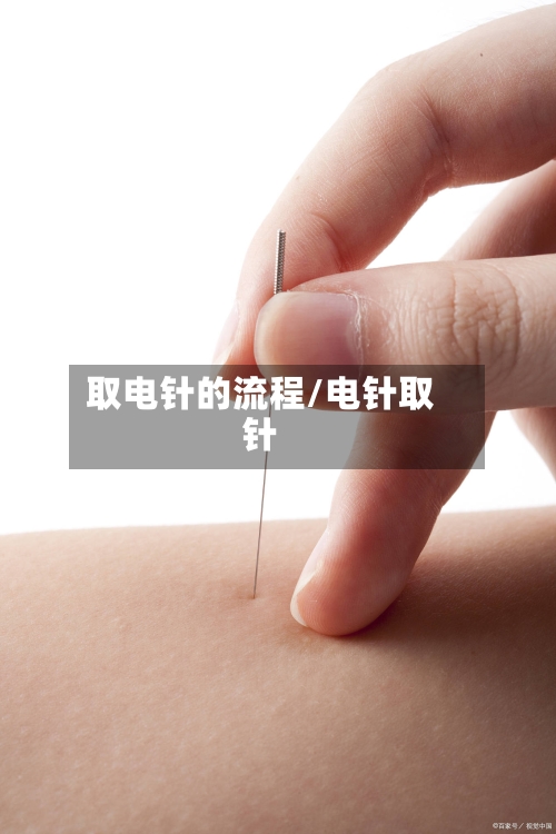 取电针的流程/电针取针