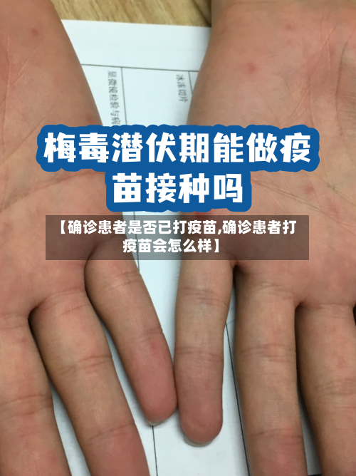 【确诊患者是否已打疫苗,确诊患者打疫苗会怎么样】-第3张图片