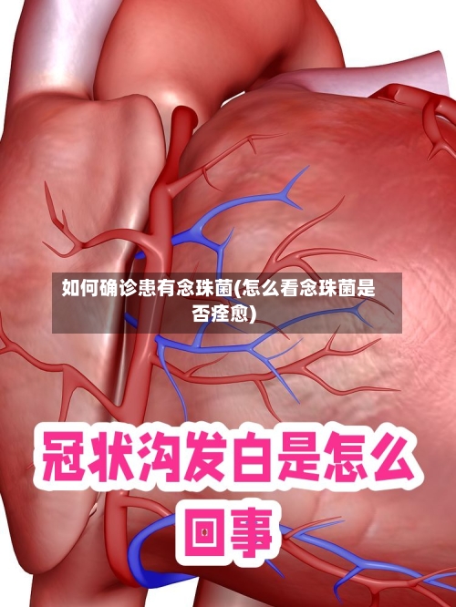 如何确诊患有念珠菌(怎么看念珠菌是否痊愈)-第2张图片