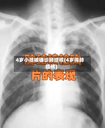 4岁小孩被确诊肺结核(4岁得肺结核)