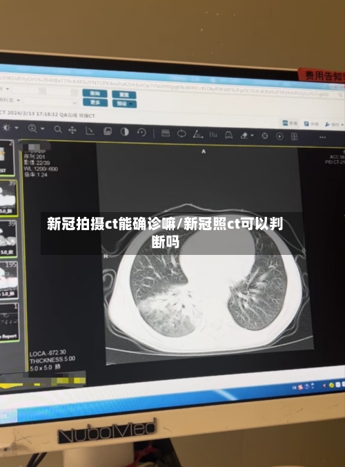 新冠拍摄ct能确诊嘛/新冠照ct可以判断吗