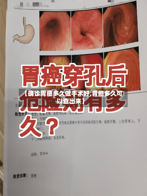 【确诊胃癌多久做手术好,胃癌多久可以查出来】