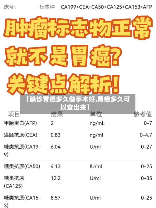 【确诊胃癌多久做手术好,胃癌多久可以查出来】-第2张图片