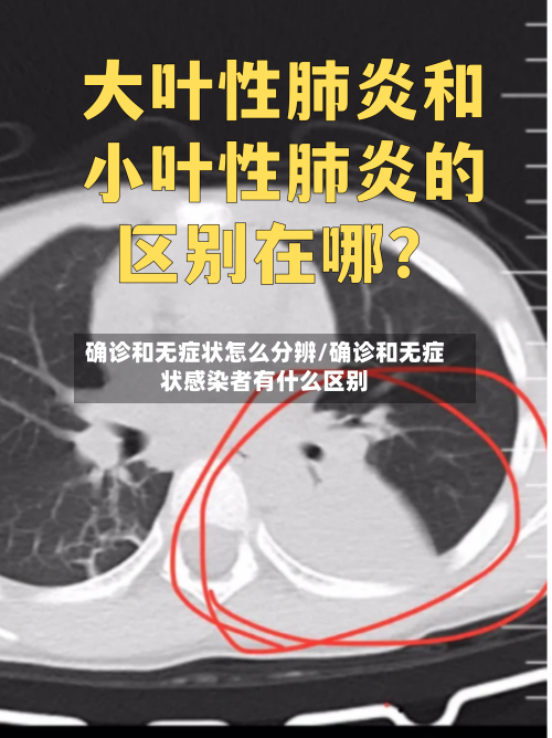 确诊和无症状怎么分辨/确诊和无症状感染者有什么区别
