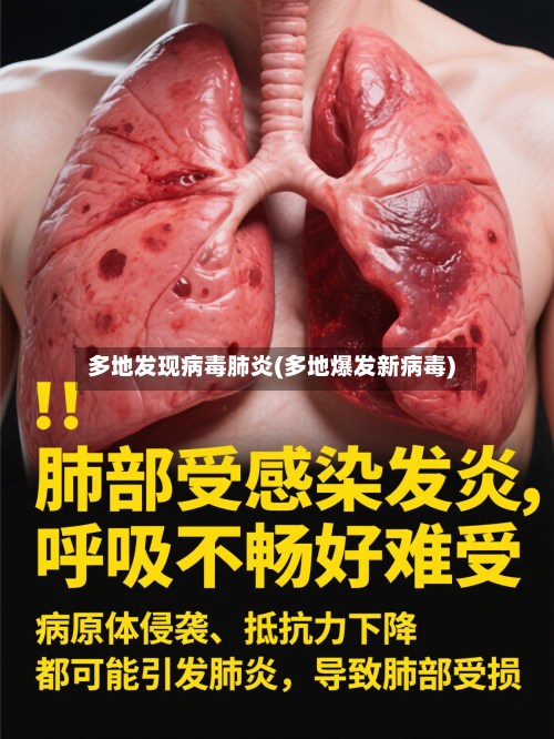 多地发现病毒肺炎(多地爆发新病毒)