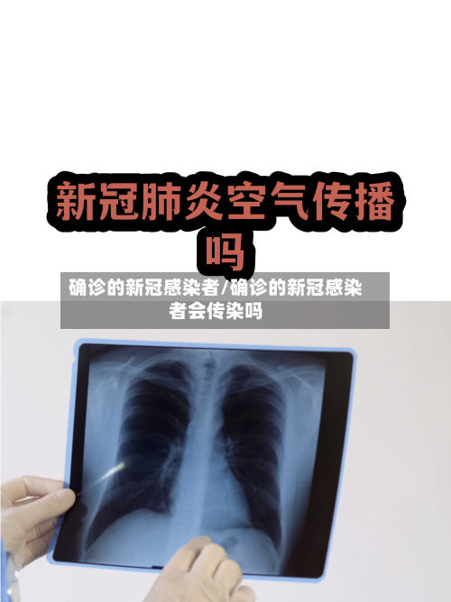 确诊的新冠感染者/确诊的新冠感染者会传染吗-第3张图片
