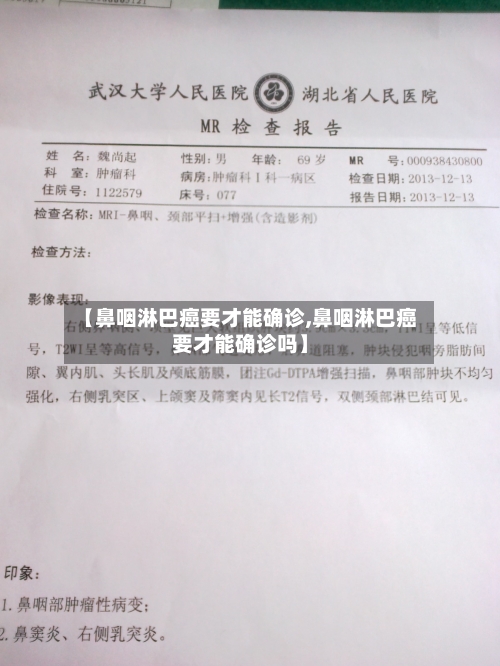 【鼻咽淋巴癌要才能确诊,鼻咽淋巴癌要才能确诊吗】-第2张图片