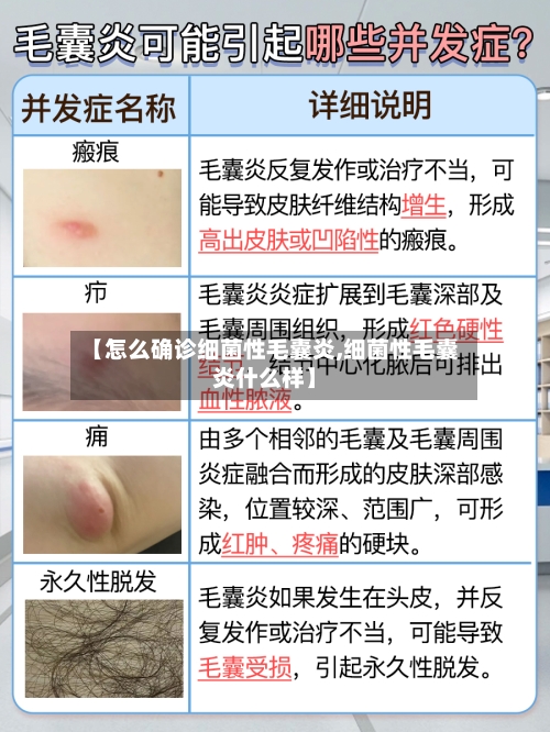 【怎么确诊细菌性毛囊炎,细菌性毛囊炎什么样】