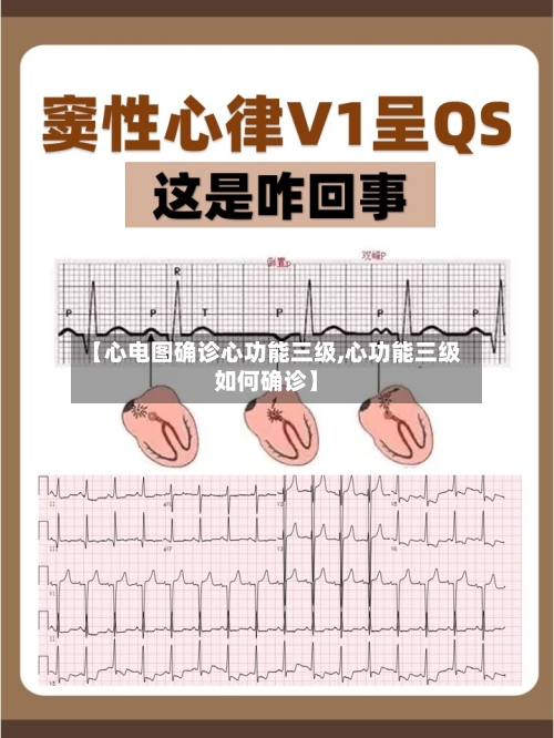 【心电图确诊心功能三级,心功能三级如何确诊】