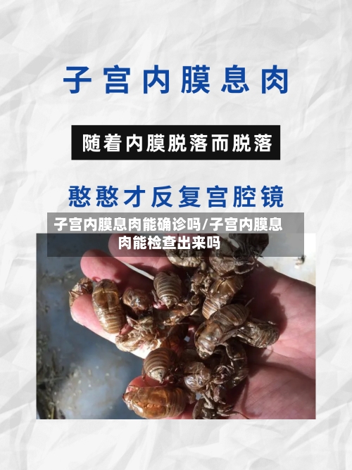 子宫内膜息肉能确诊吗/子宫内膜息肉能检查出来吗