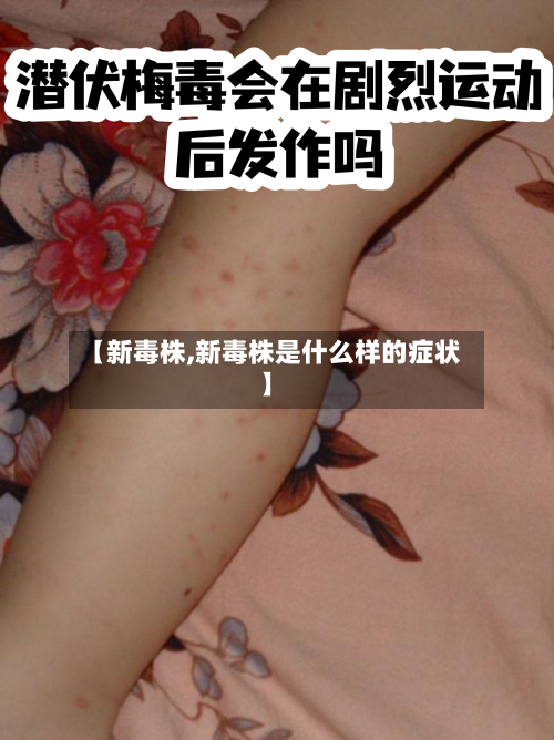 【新毒株,新毒株是什么样的症状】-第3张图片