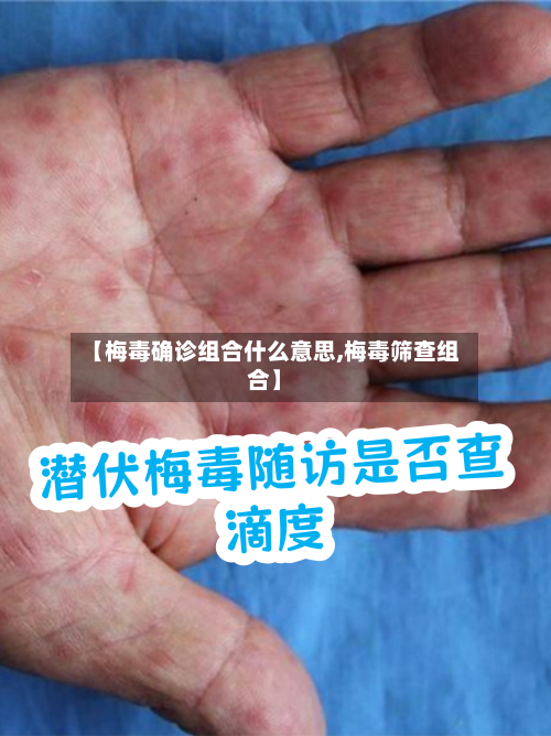 【梅毒确诊组合什么意思,梅毒筛查组合】-第2张图片
