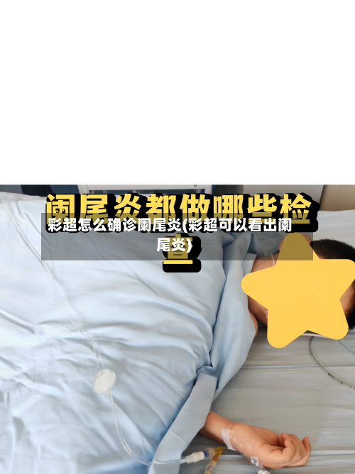 彩超怎么确诊阑尾炎(彩超可以看出阑尾炎)-第2张图片
