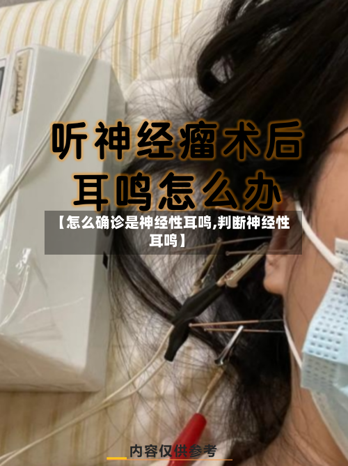 【怎么确诊是神经性耳鸣,判断神经性耳鸣】-第3张图片