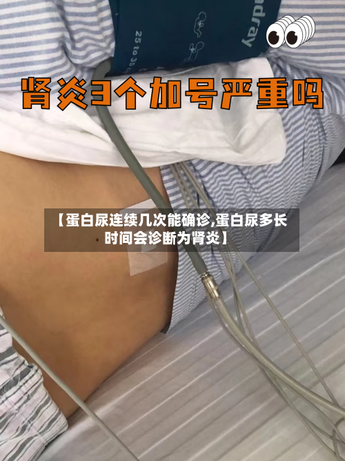 【蛋白尿连续几次能确诊,蛋白尿多长时间会诊断为肾炎】